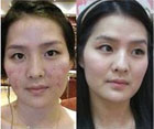 战痘士如何转身成为漂亮人妻 且看成功的逆转故事